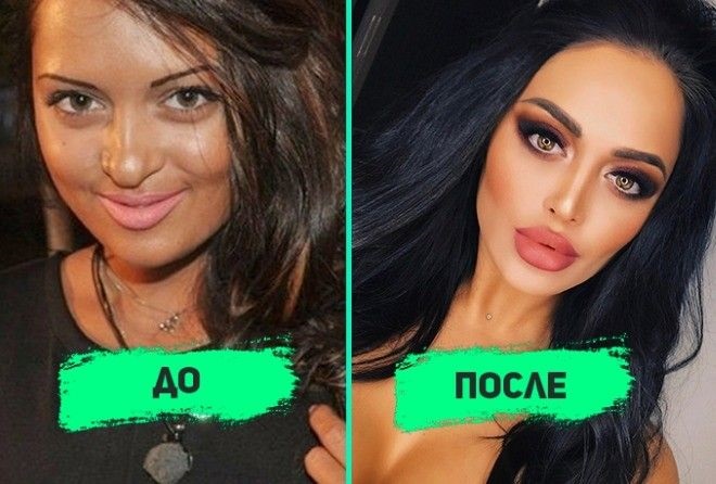 Nita Kuzmina before and after plastics. Photo, what operations the star did, biography