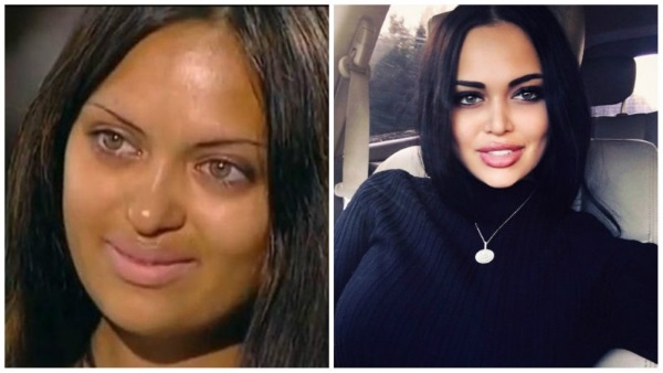 Nita Kuzmina before and after plastics. Photo, what operations the star did, biography