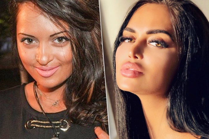 Nita Kuzmina before and after plastics. Photo, what operations the star did, biography