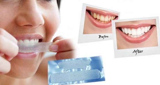 Teeth Whitening Strips: 3d white, Blend a Med, Crest, Rigel, Advanced teeth, Oral Pro, Bright light. Prices in pharmacies