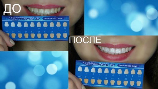 Teeth Whitening Strips: 3d white, Blend a Med, Crest, Rigel, Advanced teeth, Oral Pro, Bright light. Prices in pharmacies