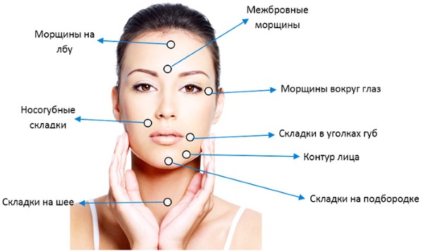 Threadlifting with 3D mesothreads for face, lips, forehead, abdomen. Before and after photos, reviews, price of the procedure