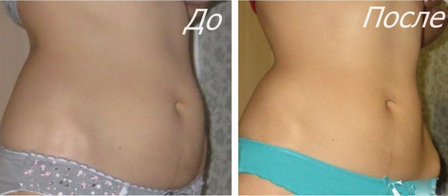 Belly vacuum.How to do exercises correctly, technique for losing weight, pumping up the press, tummy tuck after childbirth