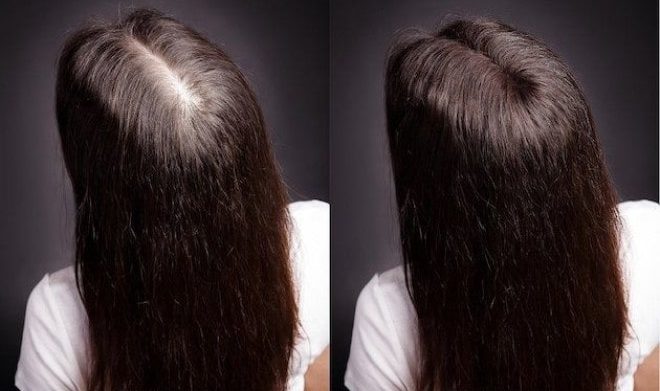 Vitamine Merz per capelli e unghie. Istruzioni per l'uso, composizione, effetti collaterali, recensioni