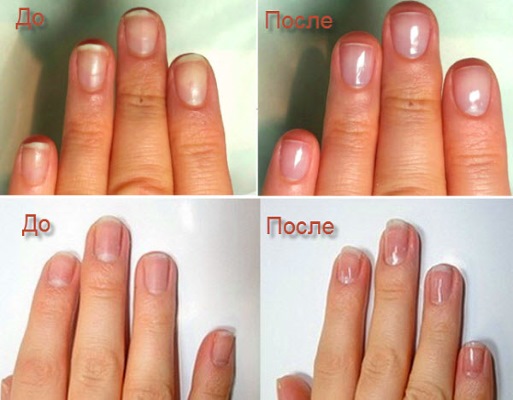 Japanese manicure: what is it, P-shine, Masura, sets and technology step by step with a photo