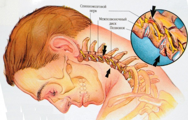 Yoga for the back and spine: features, indications and contraindications, a set of simple exercises, the best asanas. Video for beginners