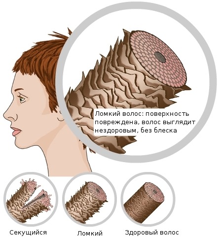 Potenzia i capelli. Foto prima e dopo, come viene eseguito il volume della radice Bust up, le conseguenze della procedura