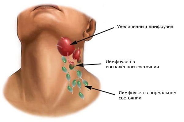 EMS (EMS) training - what is it, the benefits and harms, results, photos, doctors' reviews about myostimulation