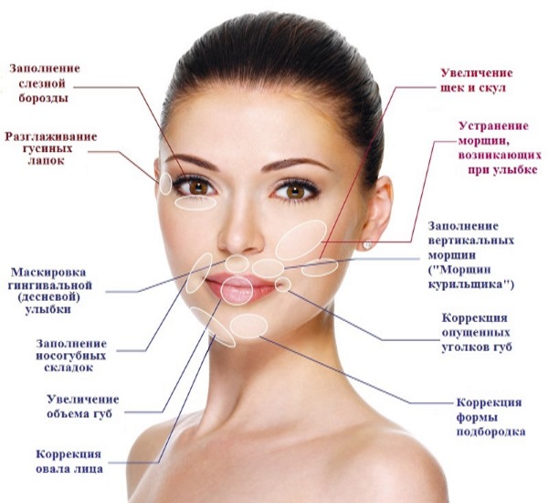 Fillers in the nasolabial folds, under the eyes, in the lips, in the cheekbones. Correction of the nose, nasolacrimal groove. Facial contouring