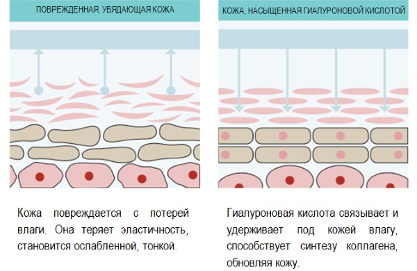 Phonophoresis of the face with hydrocortisone, caripain, hyaluronic acid. Indications and contraindications, devices for ultrasound procedures