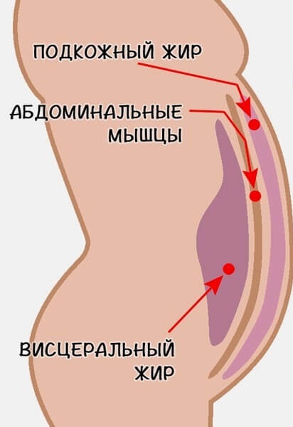 How to get rid of belly fat quickly, in a week, a month, at home. Top, bottom, sides, waist: exercise