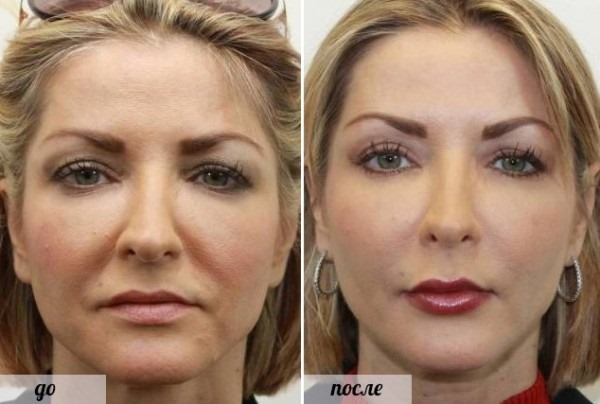 How to make cheekbones on the face and remove cheeks. Exercise, massage, diet, make-up and hair