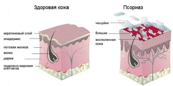 Skin-Cap Cream. Instructions for use, price, reviews, analogues