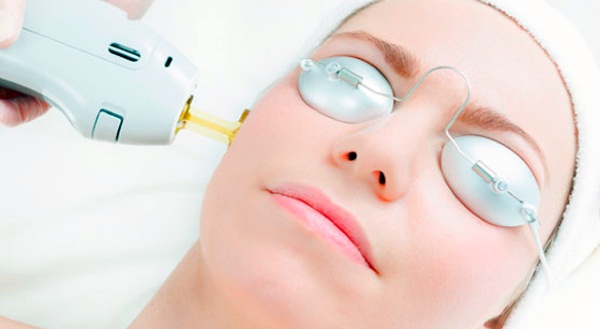 Laser fractional rejuvenation of the face, body skin. Clear Brilliant, USA. Pros and cons, reviews