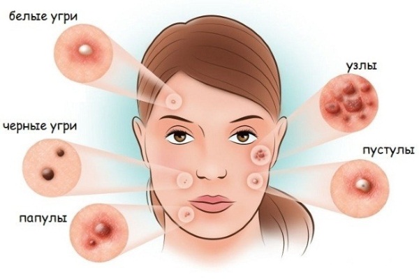 Jacquet facial massage. What is it, technique of execution, indications and contraindications