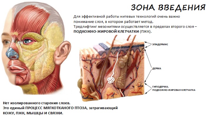 Face lifting: what is it, SMAS, RF, plasma, massage, ultrasonic, filament, endoscopic, radio wave, vector, radio frequency, laser, acupuncture