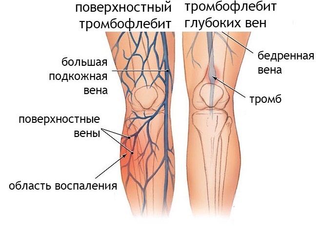 Lymphatic drainage massage for face and body. Hardware and manual technique, how to do it at home