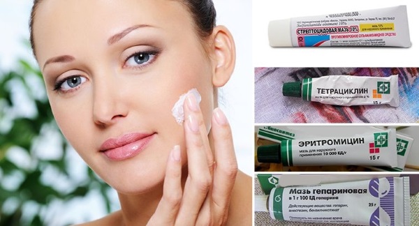 The best remedies for acne on the face. Inexpensive creams, lotions, ointments in the pharmacy