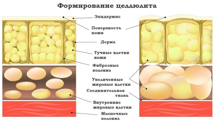 Honey massage for cellulite. How to do it right for losing weight on the abdomen, back, legs, buttocks at home. Video lessons