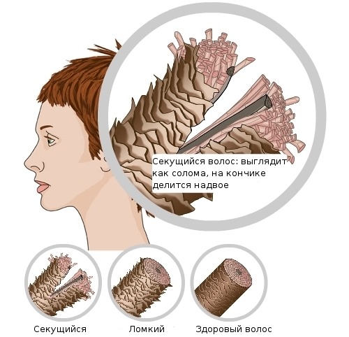 Perfectil Vitamine tricologiche per capelli. Composizione, istruzioni, indicazioni per l'uso, analoghi, prezzo