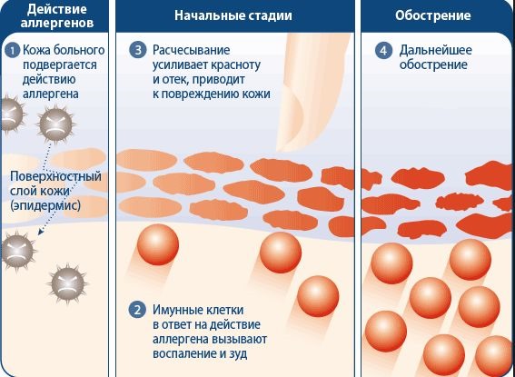 Perfectil Vitamine tricologiche per capelli. Composizione, istruzioni, indicazioni per l'uso, analoghi, prezzo