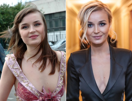 Photos of women before and after losing weight: Gagarina, Chekhov, Kartunkov, Kamenskikh, Afrikantova, Belotserkovskaya and other stars