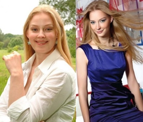 Photos of women before and after losing weight: Gagarina, Chekhov, Kartunkov, Kamenskikh, Afrikantova, Belotserkovskaya and other stars