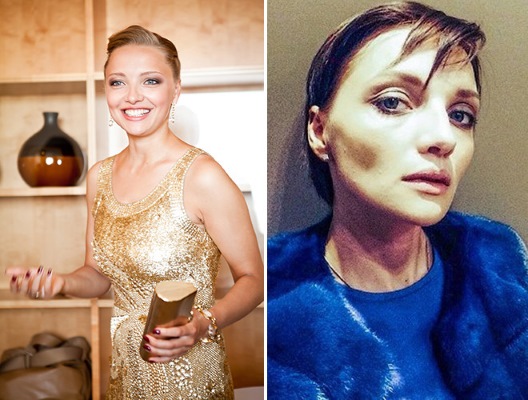 Photos of women before and after losing weight: Gagarina, Chekhov, Kartunkov, Kamenskikh, Afrikantova, Belotserkovskaya and other stars