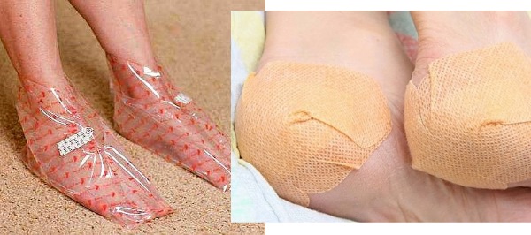 Causes and treatment of cracked heels at home. Preparations, ointments, hydrogen peroxide, aspirin, folk remedies