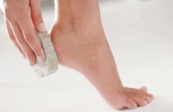 Causes and treatment of cracked heels at home.Preparations, ointments, hydrogen peroxide, aspirin, folk remedies