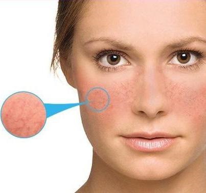 Cosmetici da farmacia, indice di popolarità: per pelli problematiche, per acne, antietà. Marchi francesi, russi