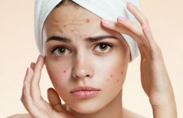 Cosmetici da farmacia, indice di popolarità: per pelli problematiche, per acne, antietà. Marchi francesi, russi