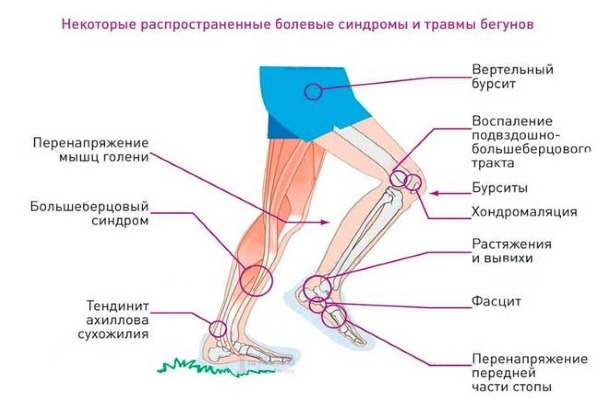 Jogging in the morning for weight loss. Pros and cons, when is the best, how to start. Results, schedule, rules