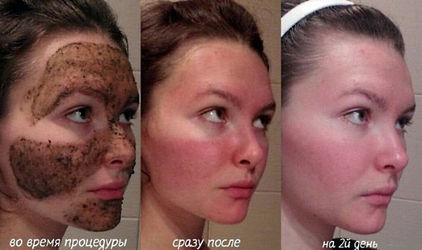 Bodyagu for the face from bruises, acne, age spots. Instructions, recipes for use, results and photos