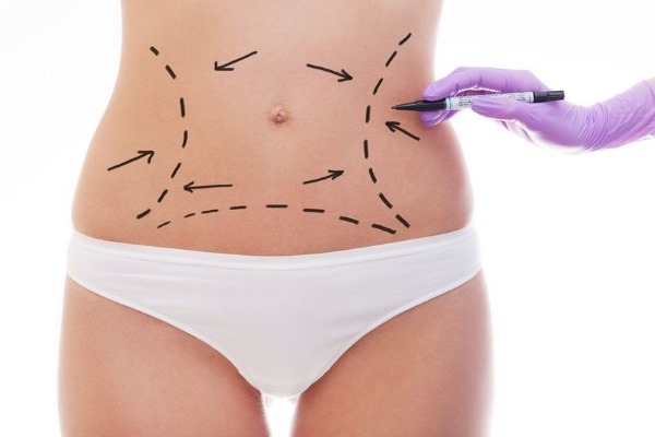 Laser liposuction. What is it, how is it done for the abdomen, chin, face, thighs, cheeks, legs, buttocks, arms, widow's hump. Before and after photos, reviews, price of the procedure