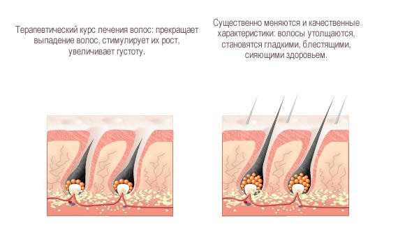 Masks for hair growth and hair loss with Dimexide and vitamins, sea buckthorn, burdock oil. Recipes