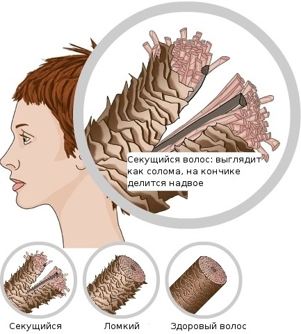 Mummy for hair. Properties and application in cosmetology, how to add to shampoo. Reviews of trichologists and dermatologists