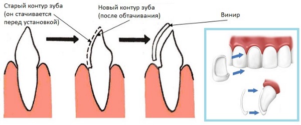 Olga Drozdova before and after plastic surgery. Photo in youth, how it looks now, how it has changed