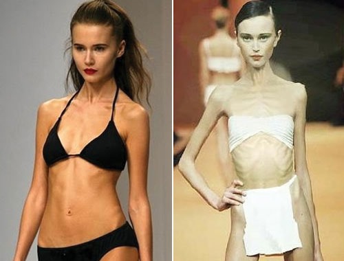 The worst person in the world is a woman. Anorexic girls, models, celebrities. A photo