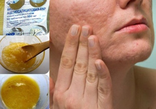 Facial scrubs. Professional and homemade recipes for sensitive and problem skin