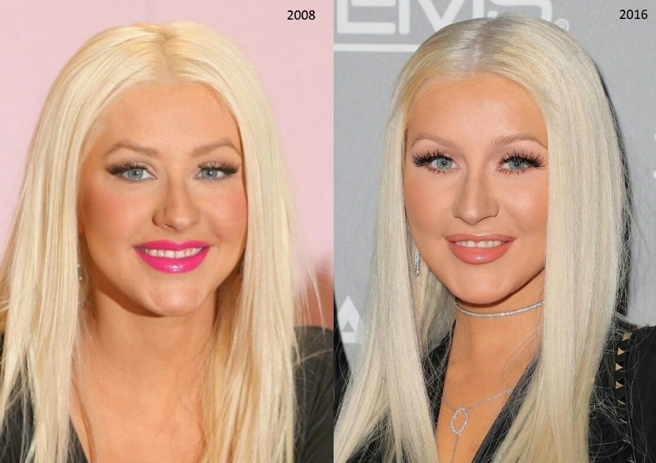 Stars before and after plastic surgery. Photos Russian, Hollywood, Korean, unsuccessful, victims, Instagram, at home 2