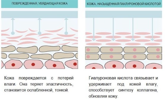 Hyaluronic acid in cosmetology. Injections, tablets, face creams. Benefits, before and after photos. Drug reviews