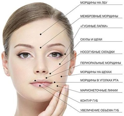 Hyaluronic acid in cosmetology. Injections, tablets, face creams. Benefits, before and after photos. Drug reviews