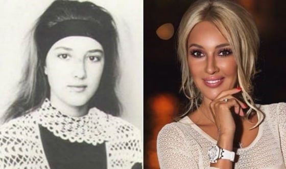 Lera Kudryavtseva. Foto prima e dopo la chirurgia plastica, in gioventù, senza trucco, età, parametri corporei. Come è cambiata la stella