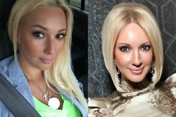 Lera Kudryavtseva. Foto prima e dopo la chirurgia plastica, in gioventù, senza trucco, età, parametri corporei. Come è cambiata la stella