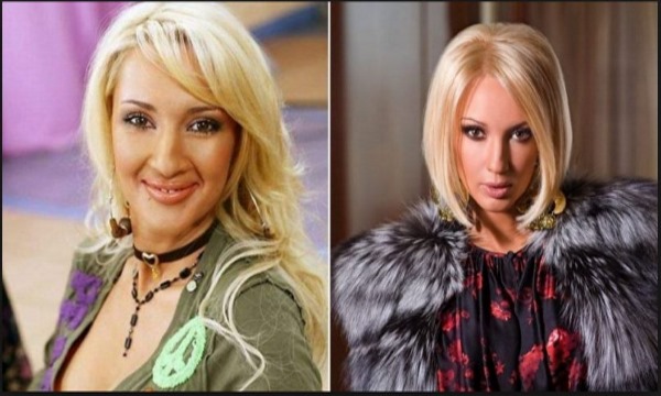 Lera Kudryavtseva. Photos before and after plastic surgery, in youth, without makeup, age, body parameters. How the star has changed