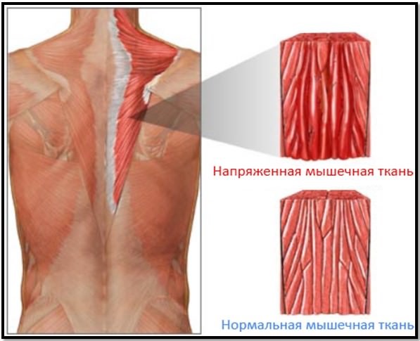 How to remove lactic acid in muscles from the body after training, how it is formed, how it affects, features