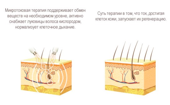 Breast lift without implants. Procedures and methods for elasticizing breasts in cosmetology