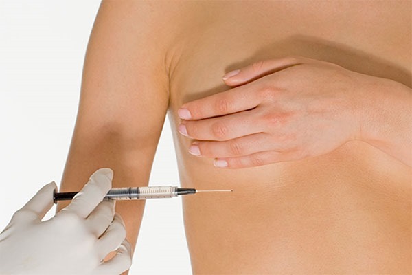 Breast lift without implants. Procedures and methods for elasticizing breasts in cosmetology