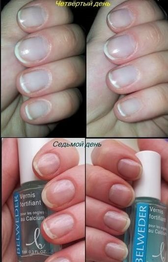 Strengthening nails at home with folk remedies, gel, acrylic, powder, sea salt